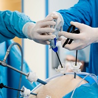 Best Laparoscopic Surgery Hospital in Dehradun – Panacea Hospital