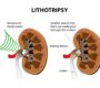 Lithotripsy Hospital in Rishikesh Panacea Hospital 1 90x80