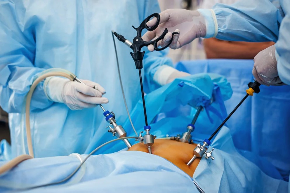 Panacea Hospital Dehradun offers advanced laparoscopic surgery with expert care by Dr. Kartik Thurwal, ensuring faster recovery and minimal pain.