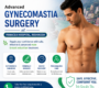 Get advanced gynecomastia surgery in Rishikesh at Panacea Hospita 1 90x80